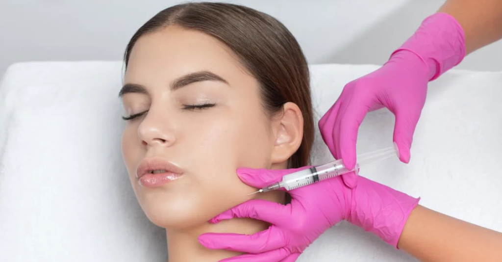 Jawline-Filler